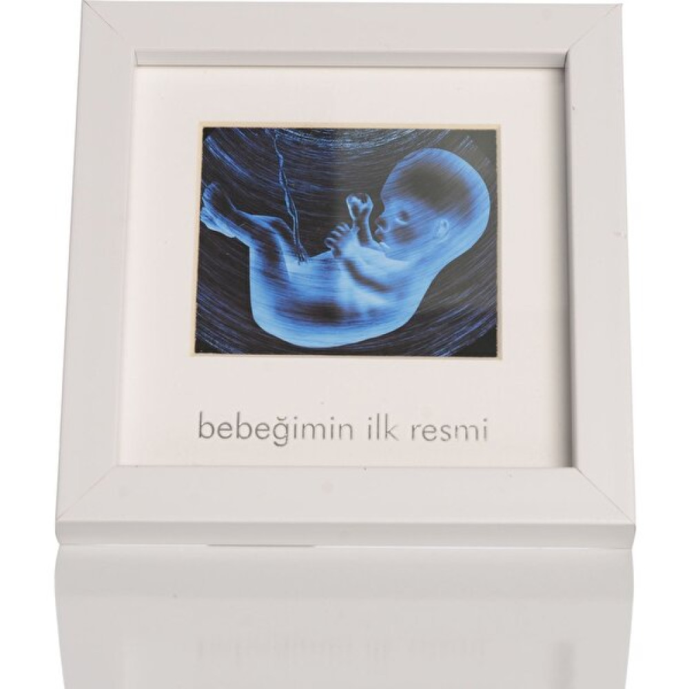 Hello Baby Bebeğimin İlk Resmi Ultrason Çerçeve Anne, Bebek Fiyatı