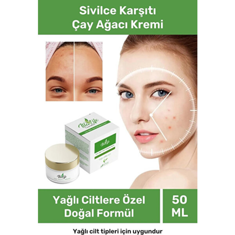 İlla Life Yağlı Ciltler İçin Sivilce Karşıtı İz Kurutucu Krem Çay Ağacı Yağı Özlü Kızarıklık Bakım Kremi 50 ml Akne ve Sivilce Bakımı Fiyatı