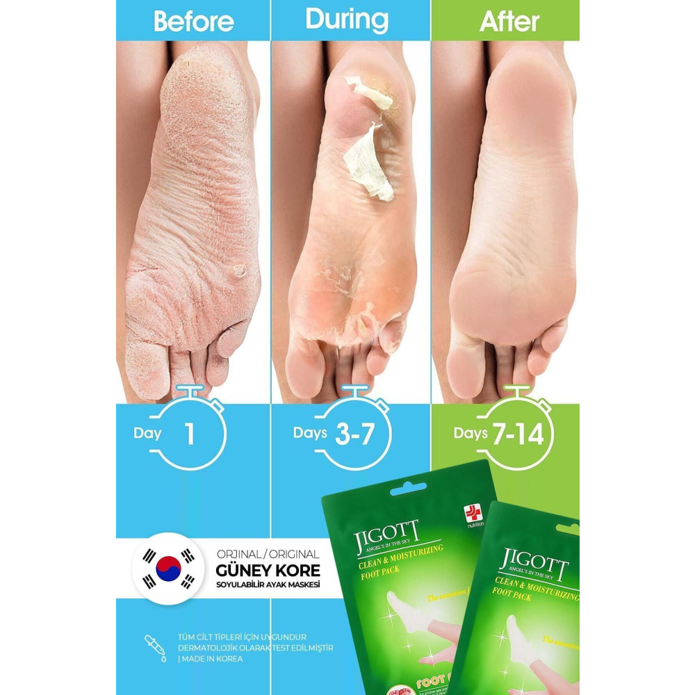 Jigott Çorap Tipi Soyulan Ayak Peeling Maskesi - Miracle Foot Peeling Pack Ayak Bakımı Fiyatı