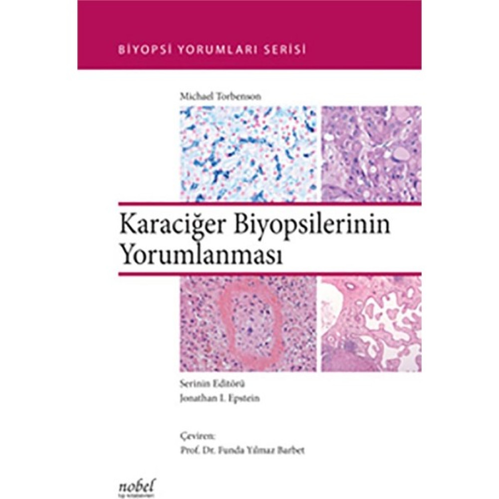 Karaciğer Biyopsilerinin Yorumlanması - Biyopsi Yorumları Serisi Tıp Kitapları Fiyatı
