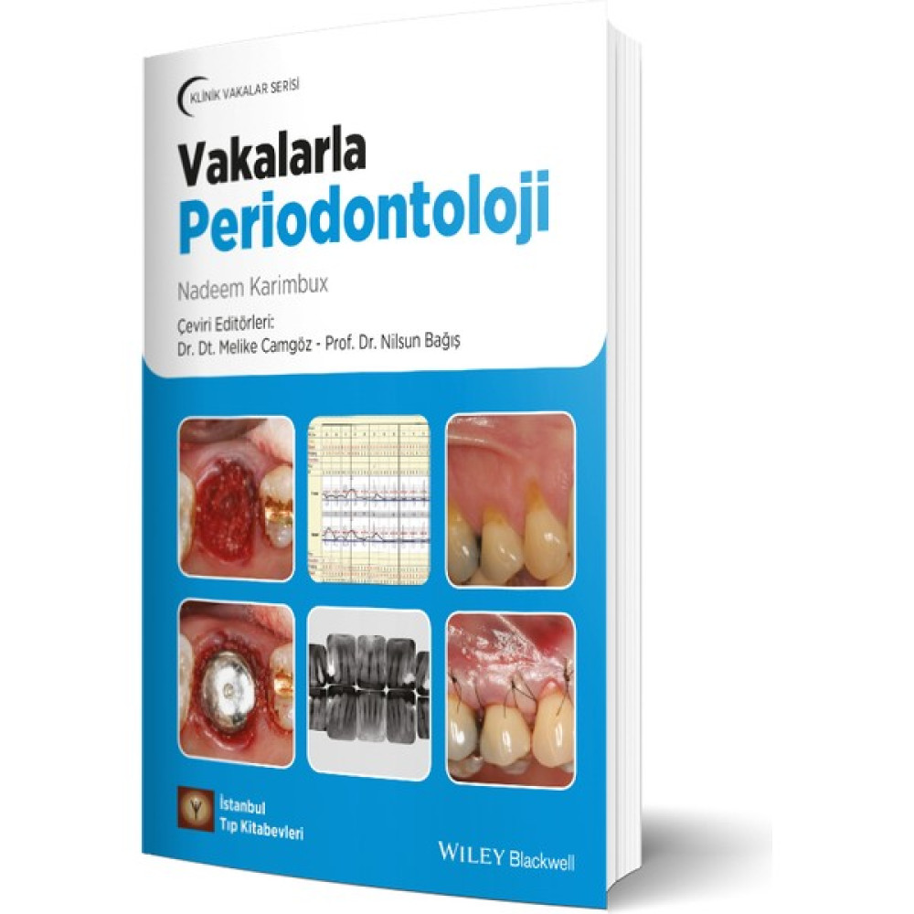 Klinik Vakalar Serisi Vakalarla Periodontoloji Tıp Kitapları Fiyatı