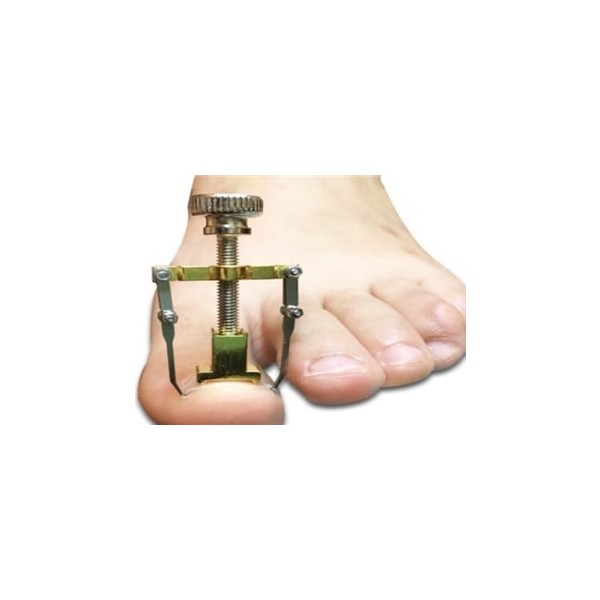 Magic Gift Batık Tırnak Çıkartıcı Aparat Diğer Fiyatı
