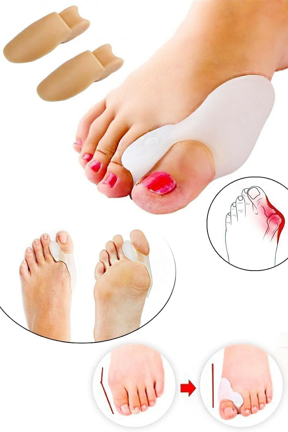 MEFKURE STORE Silikon Makaralı Ayak Baş Parmak Kemik Bunyon Koruyucu Bunion Halluks Valgus Set Başparmak" Ortopedik Ürünler Fiyatı