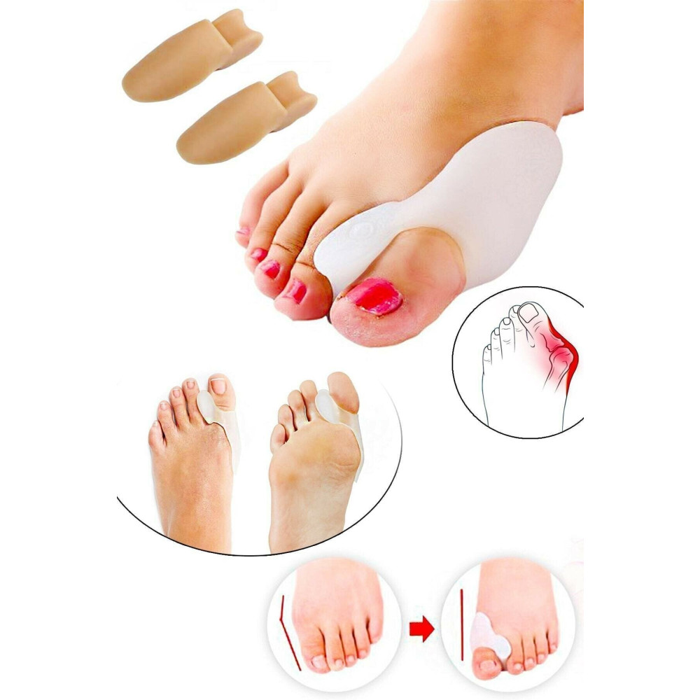 MEFKURE STORE Silikon Makaralı Ayak Baş Parmak Kemik Bunyon Koruyucu Bunion Halluks Valgus Set Başparmak Ortopedik Ürünler Fiyatı