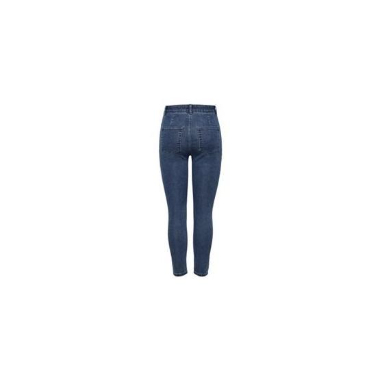 Only 15184826-MBD Fhi-Rise Skinny Mavi Kadın Kot Pantolon