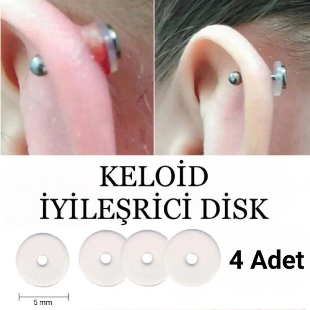 Takıconcept 4 Adet Bioplast Silikon Keloid Iyileştirici ve Önleyici Anti Hiperplazi Için Disk - Renkli Altın & Gümüş Piercing Fiyatı
