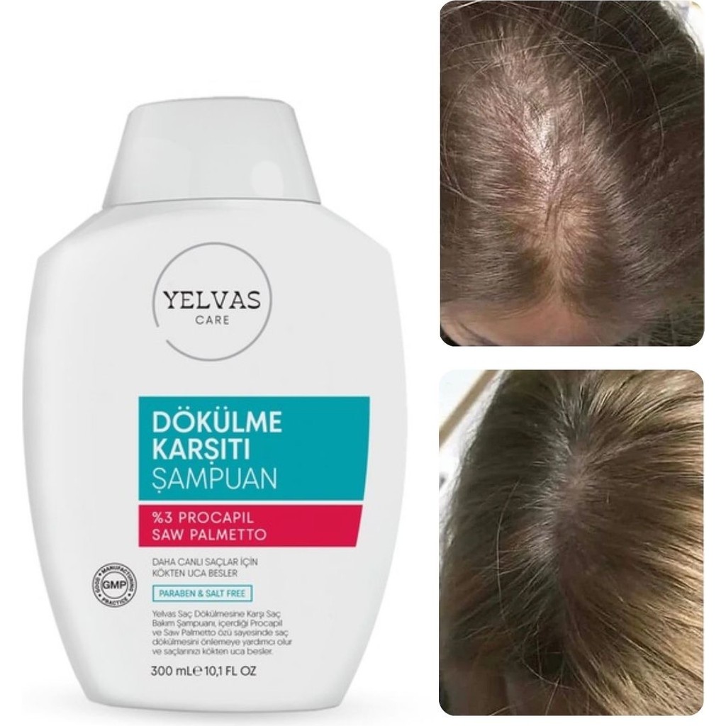 Yelvas Procapil, Saw Palmetto, ve Biotin Içerikli Saç Dökülmesine Karşı Şampuan 300 ml Saç Dökülmesine Karşı Ürünler Fiyatı